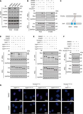 Transcriptional Repression of Ferritin Light Chain Increases Ferroptosis Sensitivity in Lung Adenocarcinoma